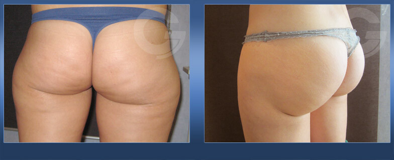 Clinic Results Gallery